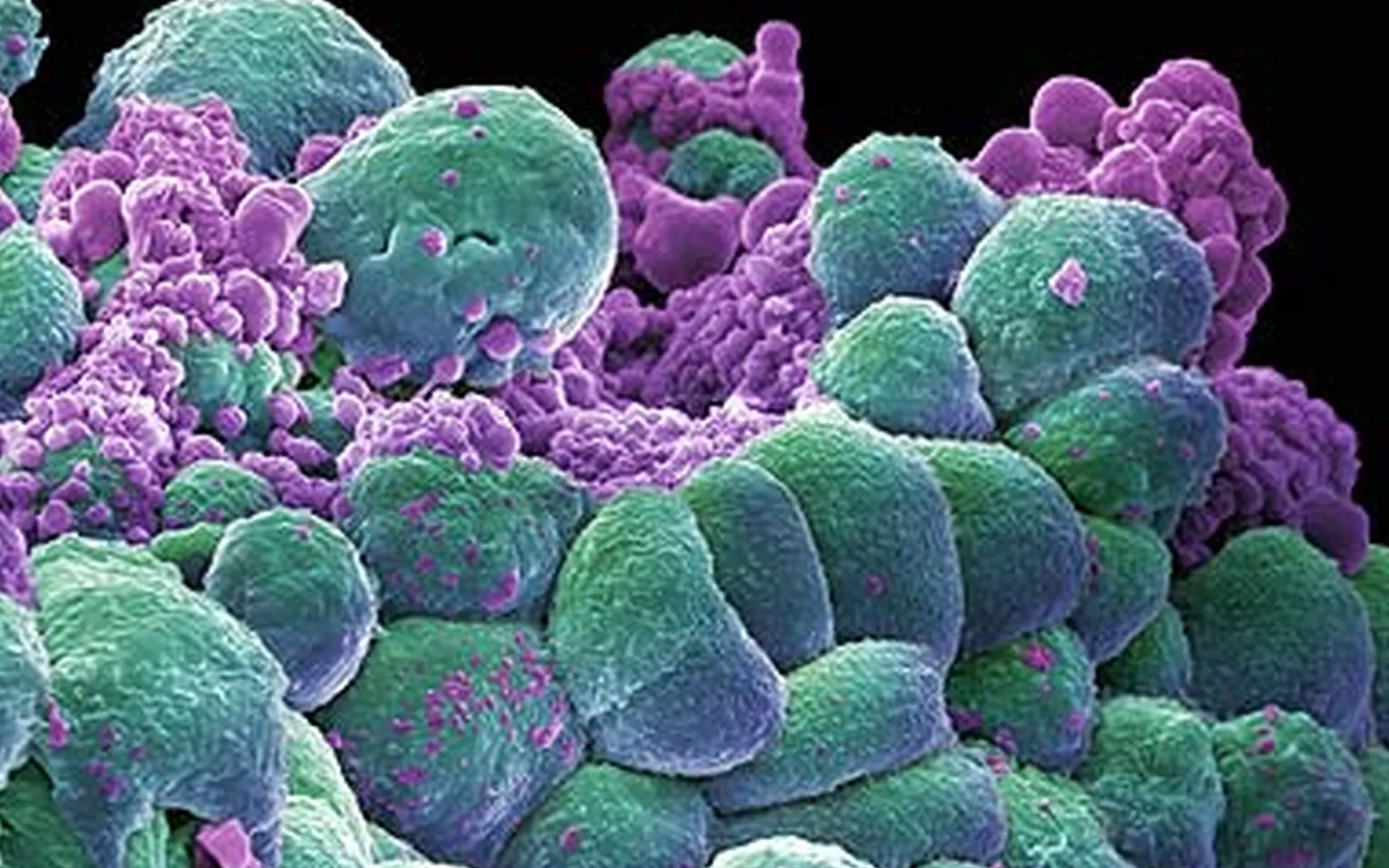 Medicii sunt uimiți. Leguma care te vindecă de cancer într-o singură zi