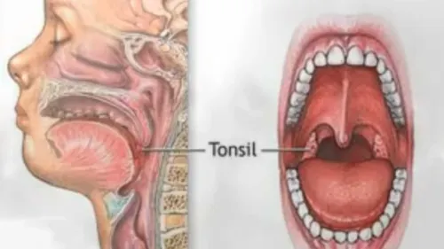 Amestecul care vindecă gâtul inflamat în doar două ore