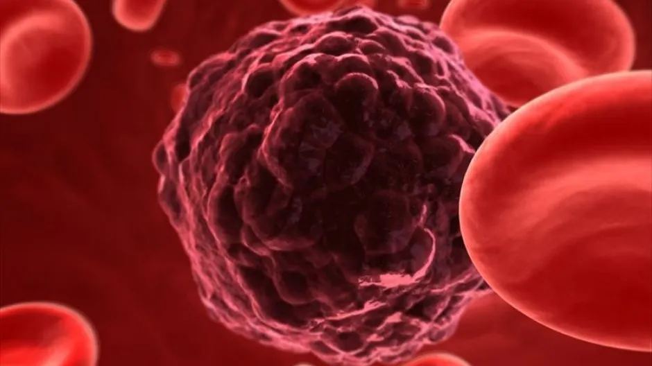 Principalele alimente care previn şi vindecă boli grave precum cancerul