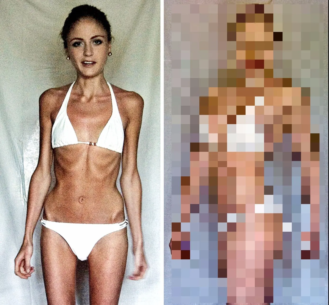 Era să moară din cauza anorexiei. Transformarea incredibilă a tinerei după ce s-a apucat de fitness