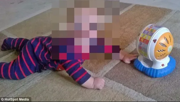 Pinocchio există și are 2 ani. Povestea bebelușului născut cu creierul în... nas. Cum arată micuțul
