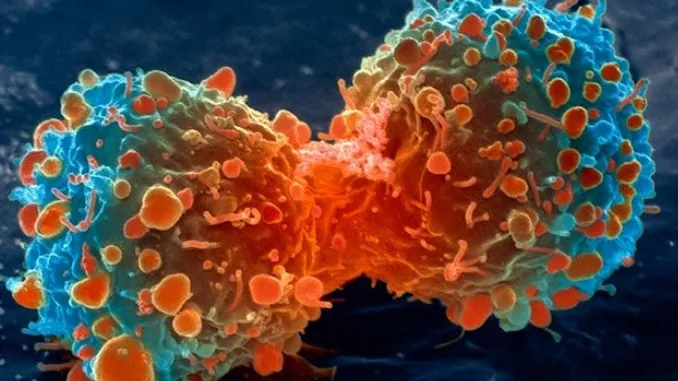 Au revoluţionat lumea întreagă! Cum arată fructele care ucid cancerul într-un minut