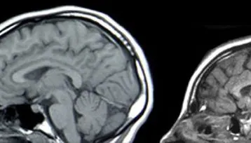 O boală teribilă răspândită din Africa dă bătăi de cap medicilor