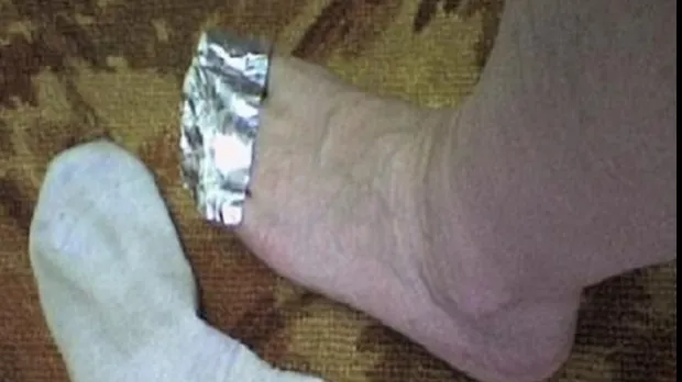 De ce e bine să-ţi pui folie de aluminiu pe degetele picioarelor. Efectul, peste așteptările tale