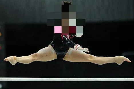 Tragedie în sport. Campioană la gimnastică, în stare gravă la spital. S-a accidentat la schi
