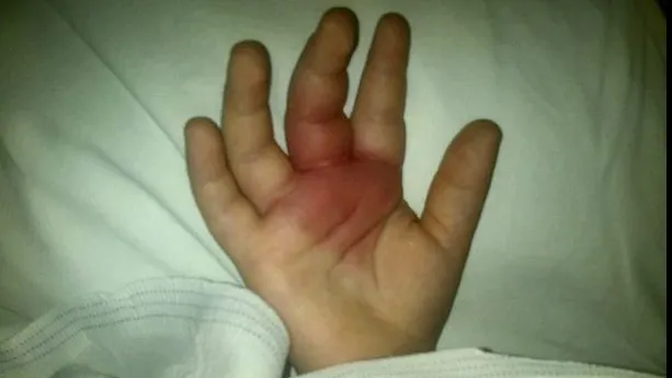 Copil paralizat, după ce a mâncat un fruct pe care toți micuții îl consumă