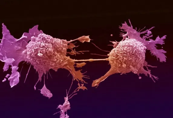 Au revoluţionat lumea întreagă! Cum arată fructele care ucid cancerul într-un minut
