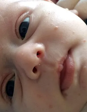 Toţi oamenii se tem să îl atingă. Băieţelul de 10 luni, spaima necunoscuţilor