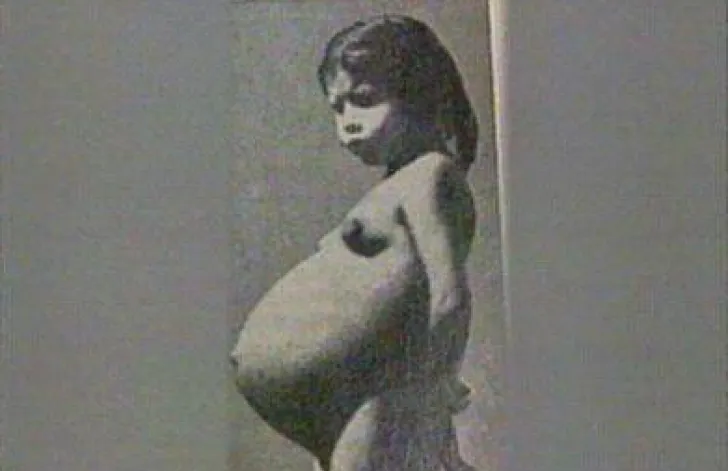 Mamă la 5 ani. Ce face acum femeia care A UIMIT MEDICINA
