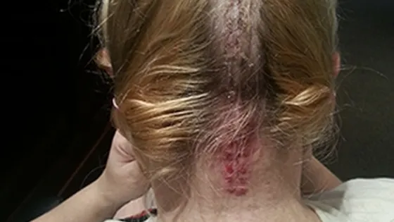 Avea amețeli și nu mai vorbea corect, iar medicii au fost șocați: "Mi-a căzut creierul din cap"