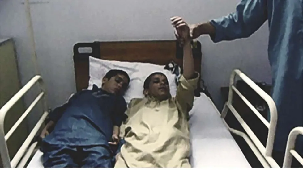 Doi fraţi din Pakistan i-au şocat pe toţi medicii. Cad seceraţi în fiecare zi când dispare Soarele