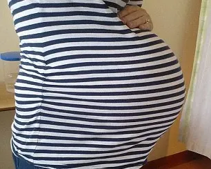 S-a chinuit 12 ore să nască. Când a venit bebelușul pe lume, medicii au rămas șocați. Așa ceva...