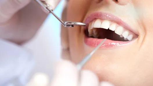 Studiu: Jumătate dintre românii care ajung la dentist au nevoie de tratamente complexe