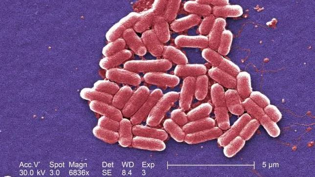 Începutul sfârșitului? Prima bacterie rezistentă la antibiotice, depistată în SUA la o pacientă