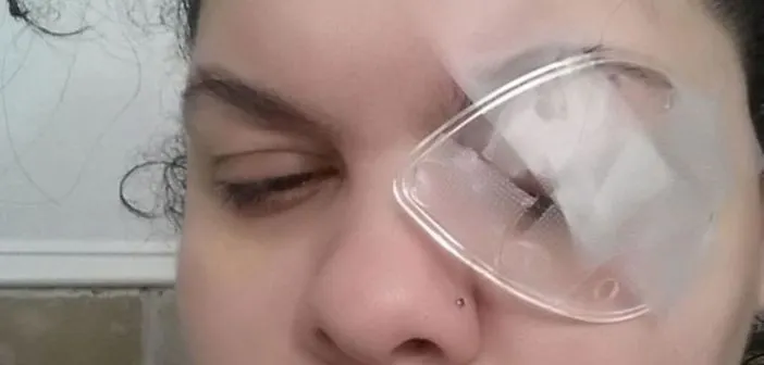 A rămas fără un ochi după ce a folosit acest produs de machiaj. E nelipsit din trusa femeilor!