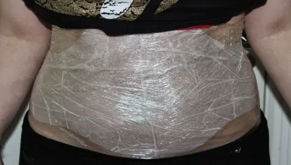 A pierdut aproape 2 cm din circumferinţa taliei într-o singură noapte. Cum este posibil