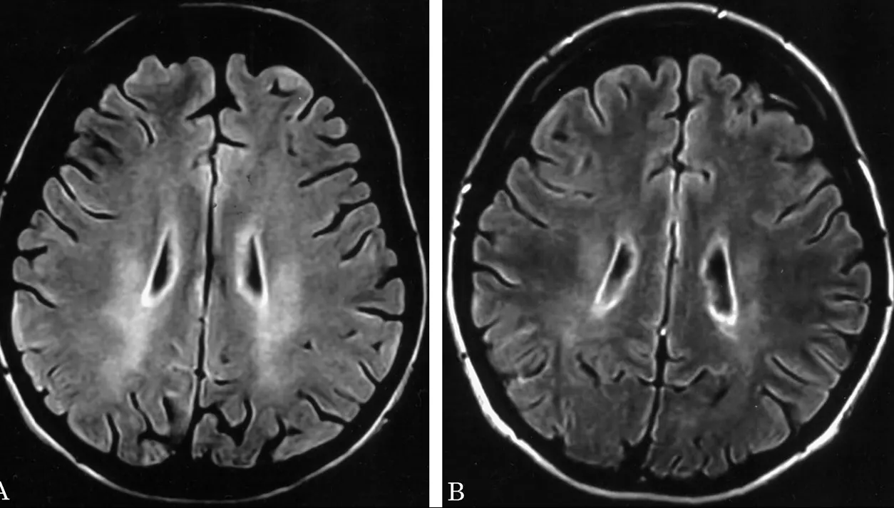 ŞOC în lumea sportivă: un celebru antrenor, diagnosticat cu o maladie neurologică. Ar putea paraliza