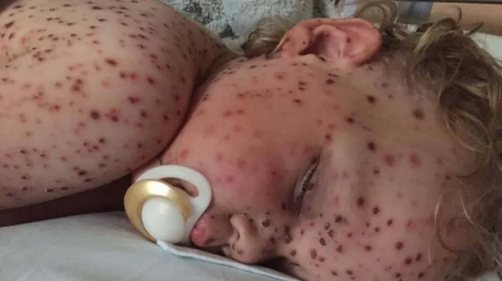 Acest copilaş a ajuns la Urgenţe. Arăta aşa! Medicii au fost şocaţi! Ce avea, de fapt