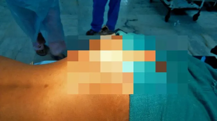 A trăit 18 ani cu O COADĂ. Medicii au fost şocaţi când tânărul a ajuns la spital: Era IMENSĂ