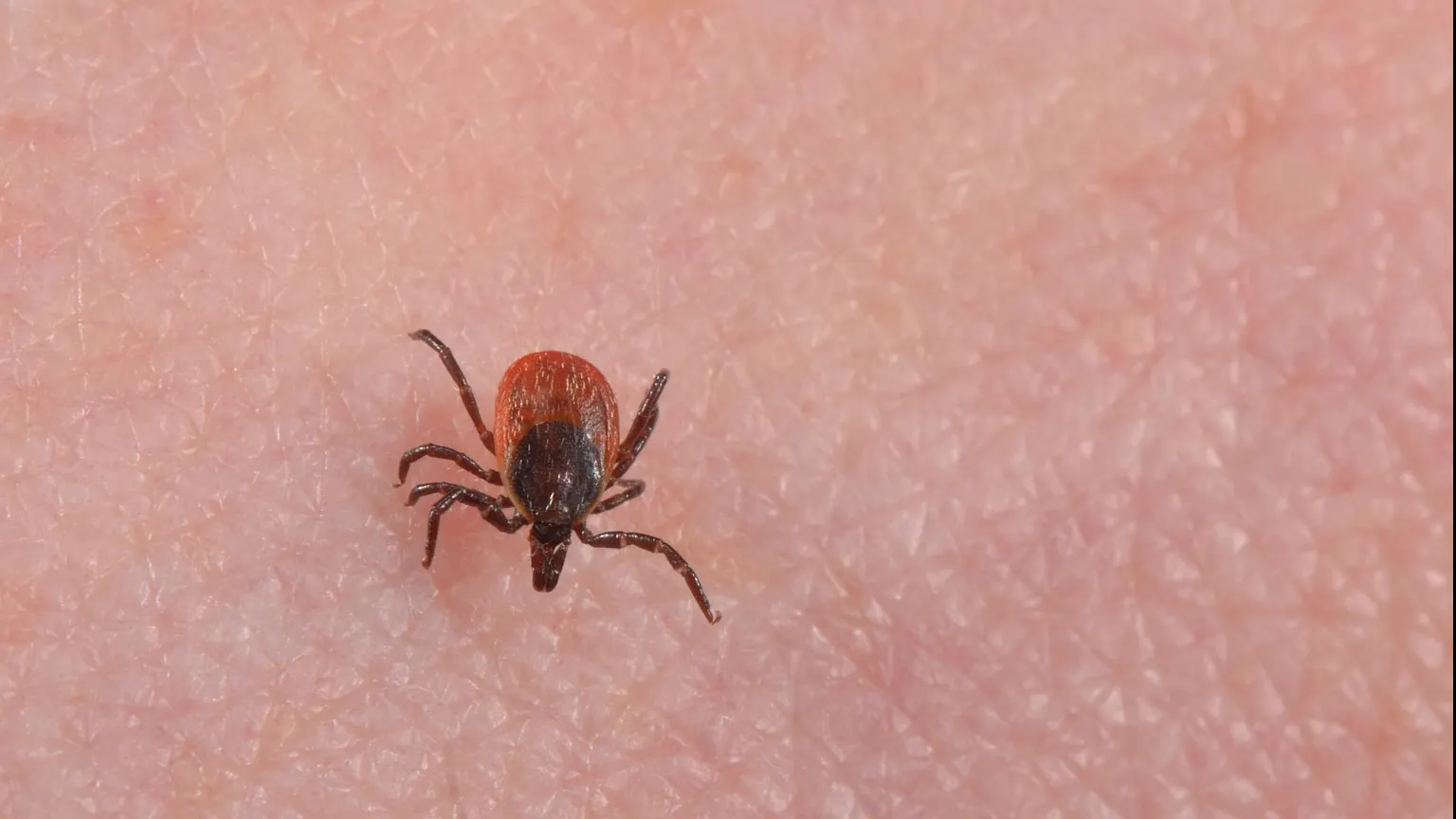 Cel mai simplu mod în care te poţi feri de căpuşe. Toată lumea trebuie să ştie acest lucru