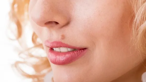 Primele simptome ale cancerului de piele. Mergi imediat la doctor dacă vezi ASTA!