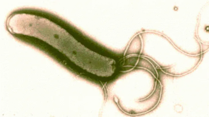 Leguma care omoară bacteria helicobacter pylori, cea care cauzează ulcerele