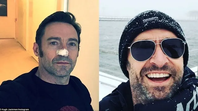 Este un adevărat învingător! Hugh Jackman luptă cu cancerul a șasea oară 