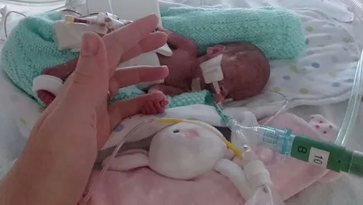 Fetiţa cât o palmă s-a născut cu 4 luni înainte de termen. 10 chirurgi au operat-o de urgenţă şi...