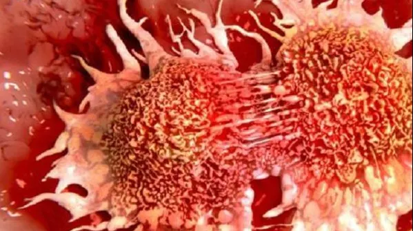 Descoperire incredibilă. Care este, de fapt, adevărata cauză a cancerului