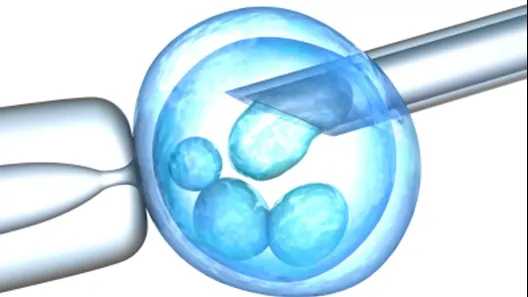Fertilizarea in vitro, o soluție posibilă atunci când medicamentele eșuează