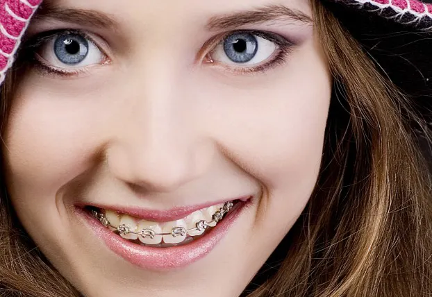 Top cinci transformări incredibile ale oamenilor care au purtat aparat dentar! Rămâi uimit