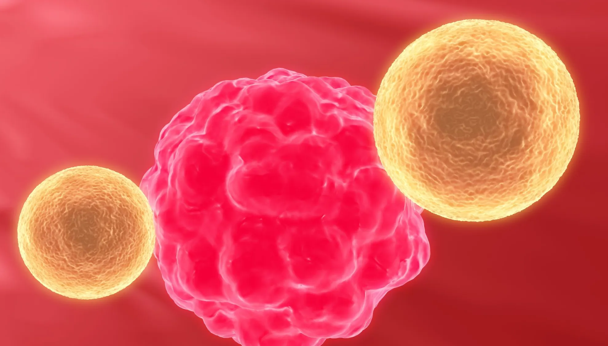 Ce trebuie să știi despre cancerul de pancreas