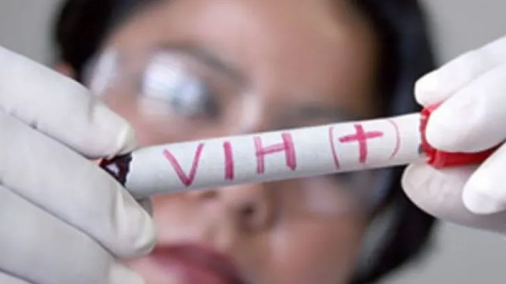 Primele semne care te anunţă că ai fost infectat cu HIV. Mergi de urgenţă la medic dacă le ai