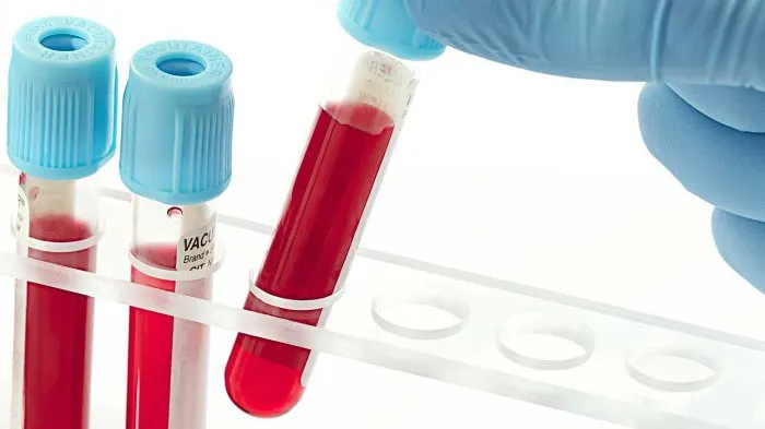 Testul de sânge care descoperă cancerul oriunde ar fi în corp