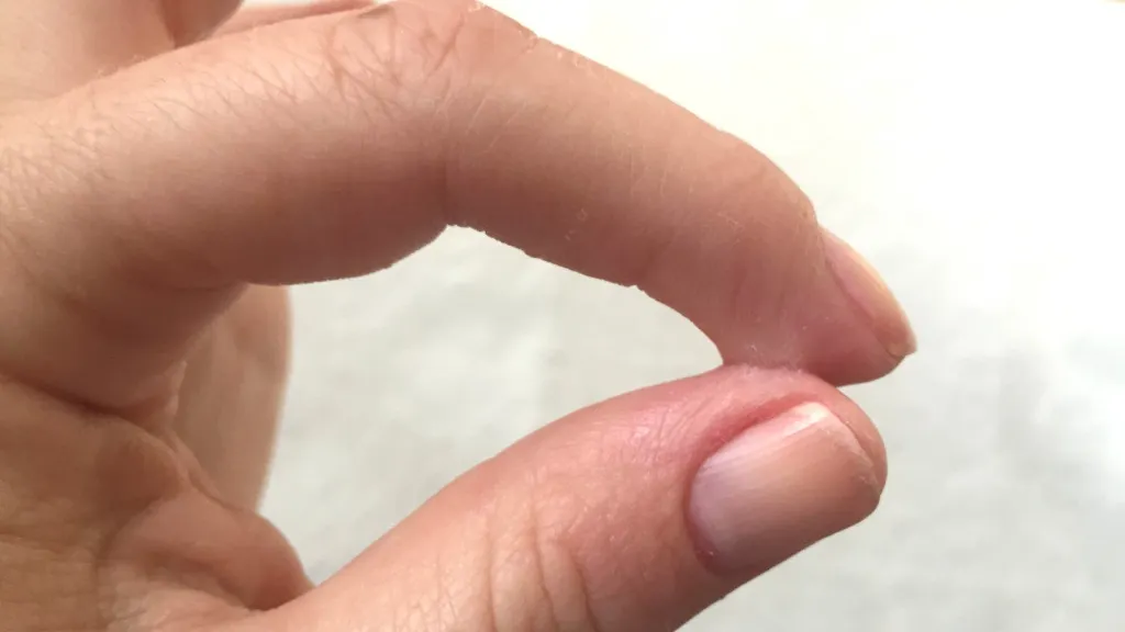 Cum poţi scăpa de super glue-ul de pe piele sau alte suprafeţe