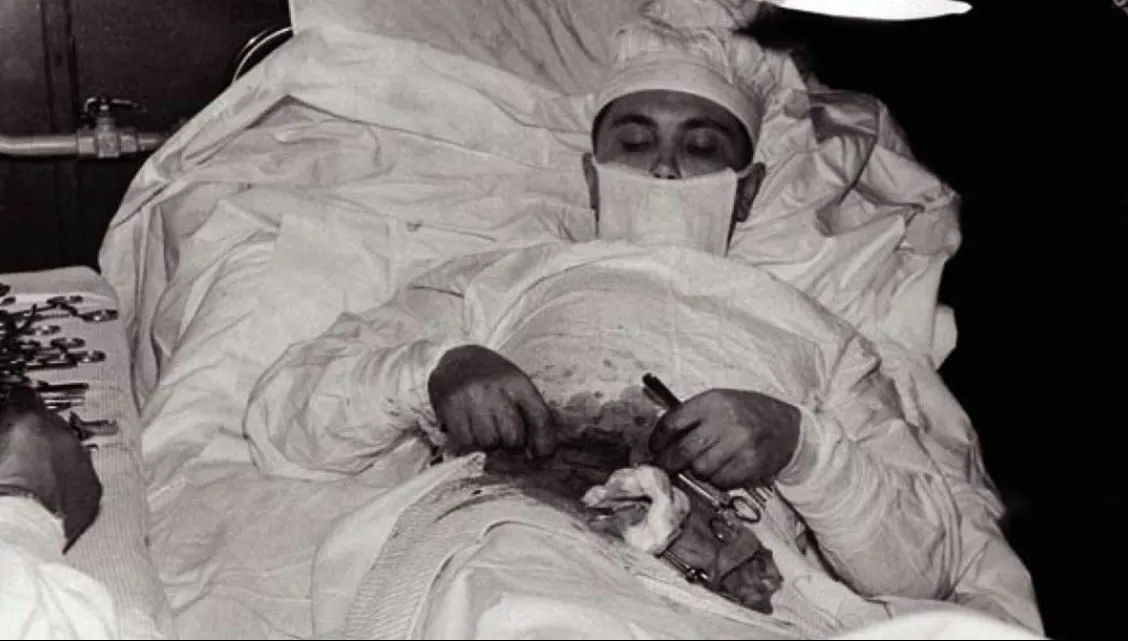 Acest doctor s-a operat singur de apendicită. Ce a urmat, este ireal: "Am simțit că-mi stă inima"