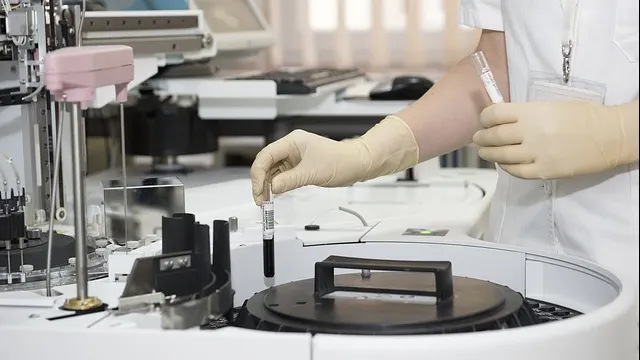 Noi informații despre depistarea și tratarea cancerului colorectal