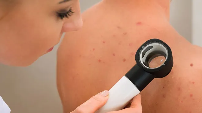 Nu te așteptai la asta. Cel mai discret tip de cancer este extrem de agresiv