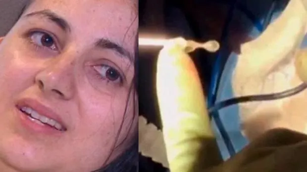 O durea capul tot mai des. Medicii i-au făcut o radiografie şi au înlemnit. "Erau peste tot"