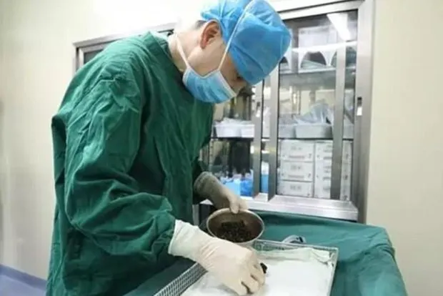 Ce au scos medicii din ficatul ei e șocant. Motivul? A sărit peste micul dejun ani de zile