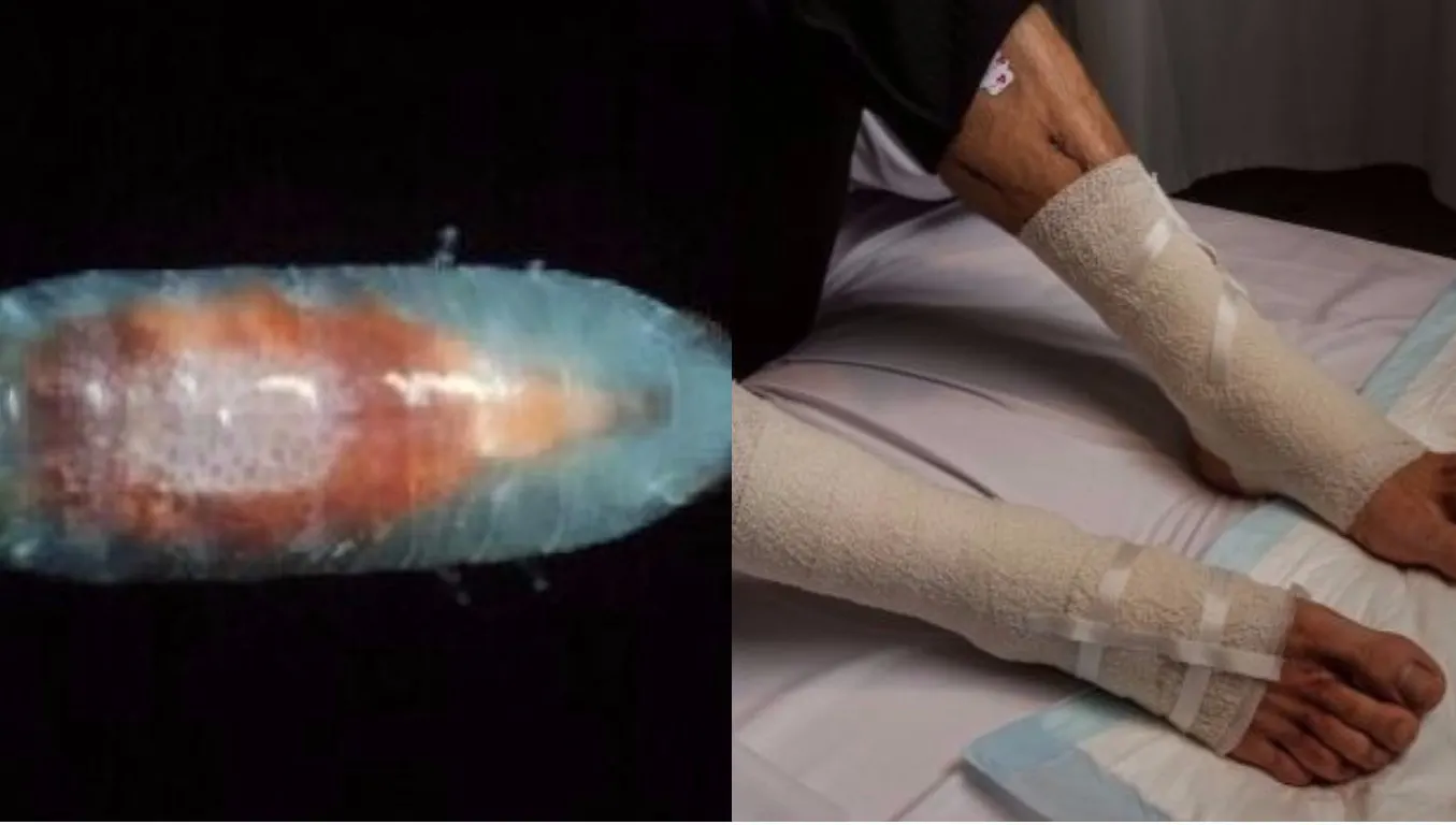 A intrat în mare și mii de viețuitoare minuscule misterioase au început să-i mănânce picioarele