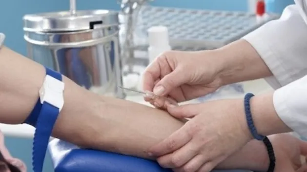 Nu ai idee cât de simplu te poți infecta cu hepatita A! Uite care sunt simptomele