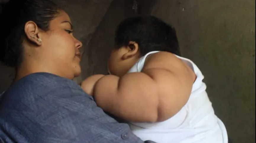 Bebeluşul fenomen: la 10 luni cântăreşte cât un copil de 9 ani.Mama a crezut că are "lapte hrănitor"