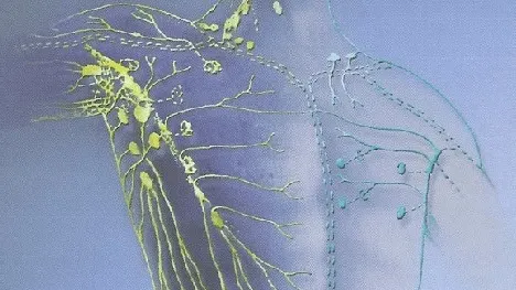 Cum să detoxifici sistemul limfatic