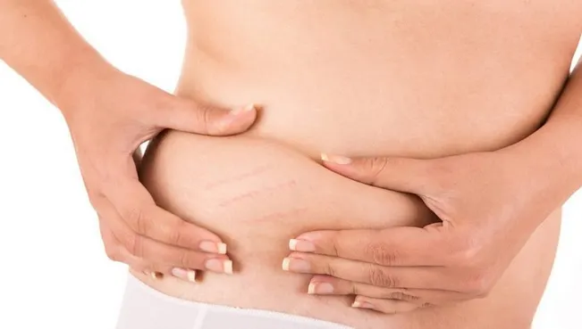 Cum reduci vergeturile: 5 trucuri pentru picioare superbe