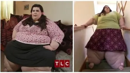 Doctorul a refuzat să o opereze pe fată. După un an a revăzut-o și nu i-a venit să creadă