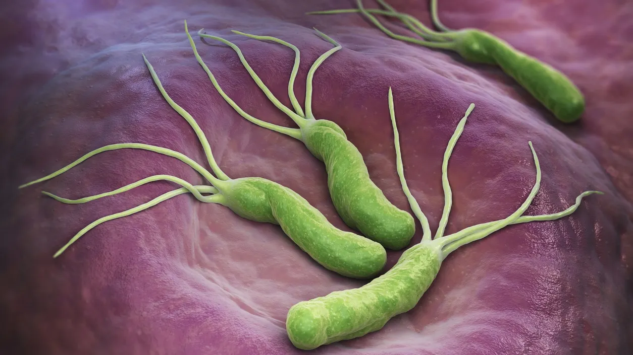 Această bacterie cauzează cancer de stomac. Cum te poţi feri de ea