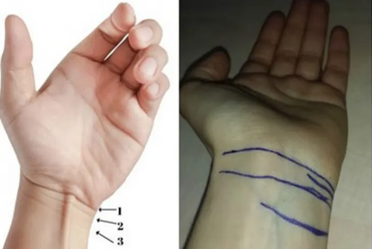 Numărul lor îți arată când vei muri. Tu câte linii ai la încheietura mâinii?