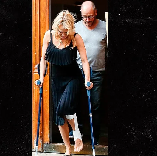 Pamela Anderson, în cârje, după accidentarea suferită