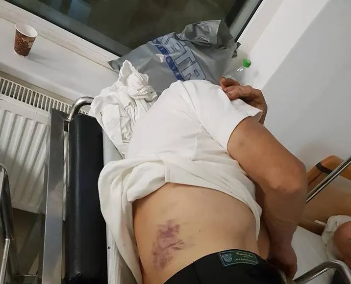 Un viceprimar din judeţul Neamţ, acuzat că a bătut un bărbat pe care l-a prins la furat porumb
